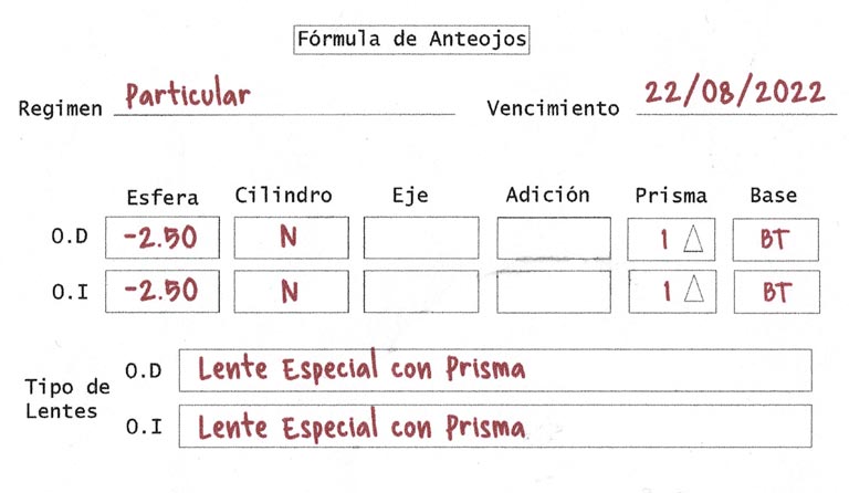 formula de gafas con prisma ejemplo